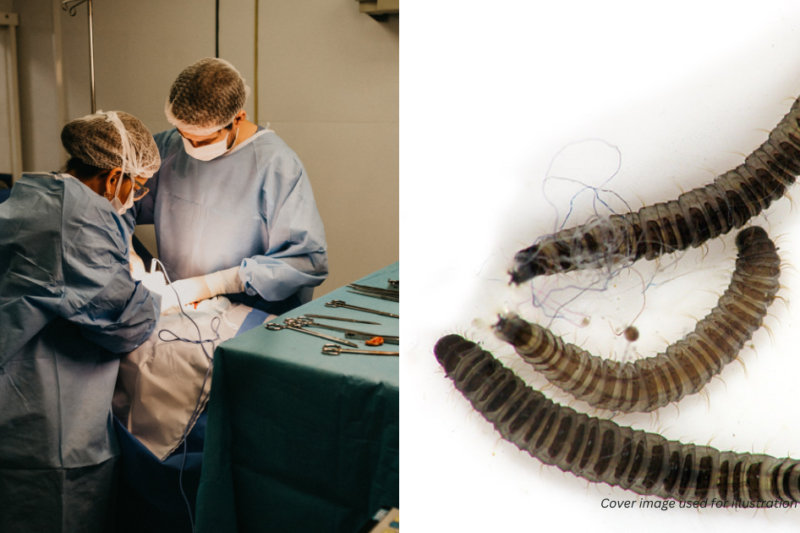 மீண்டும் பீதியை கிளப்பும் சீனா – சிறுமியின் வயிற்றில் உயிருடன் புழுக்கள்