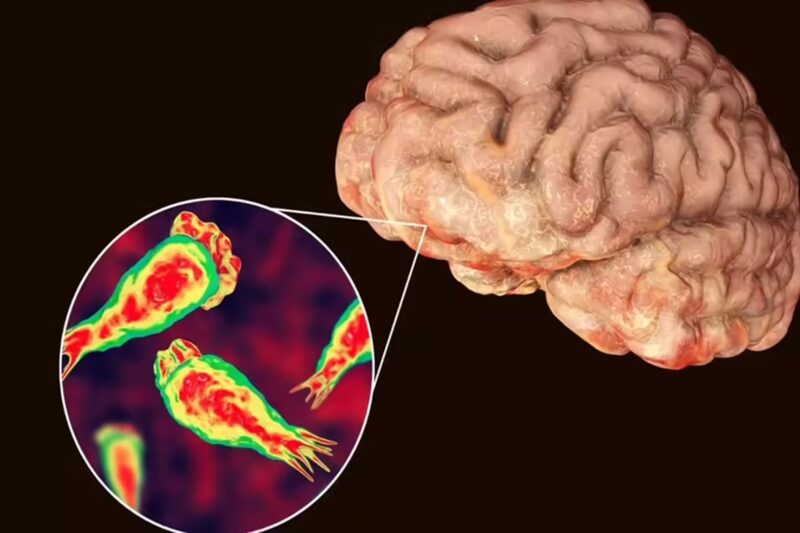 ‘மூளையைத் தின்னும் அமீபா’ நோயால் மக்கள் பீதி: 5 நாட்களில் 4 பேர் பலி!