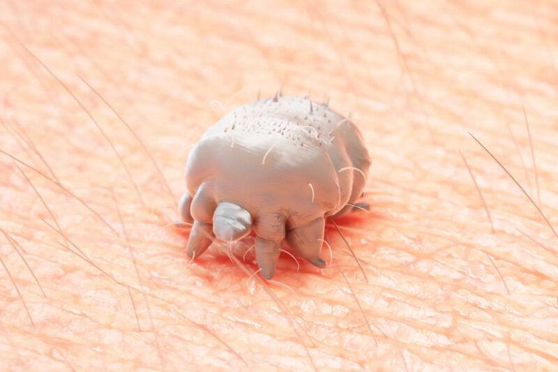 பள்ளிகளில் வேகமாகப் பரவும் பழங்கால நோய்! – குடும்பம் முழுவதற்கும் சிகிச்சை தேவை